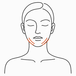 Jawline and jowls, XERF radiofrequency skin tightening London