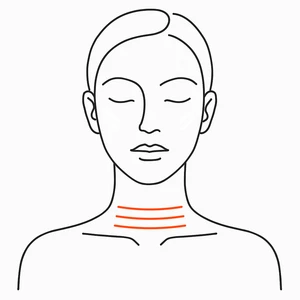 Neck, XERF radiofrequency skin tightening London