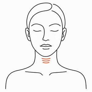 Under the chin, XERF radiofrequency skin tightening London